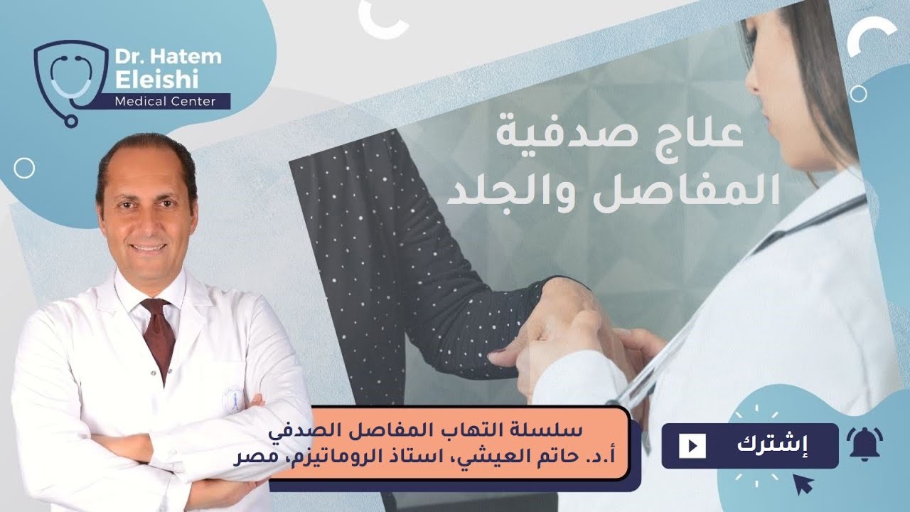 علاج مرض التهاب المفاصل الصدفي. أ.د. حاتم العيشي