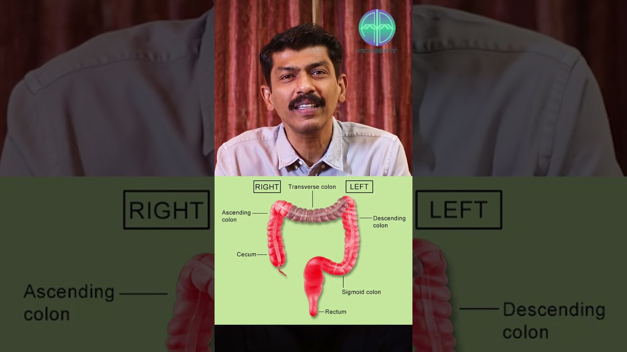 Colan Cancer  Explained in Tamil  | Dr.Ravindran Kumeran #cancertreatment #shorts #bariatricsurgery