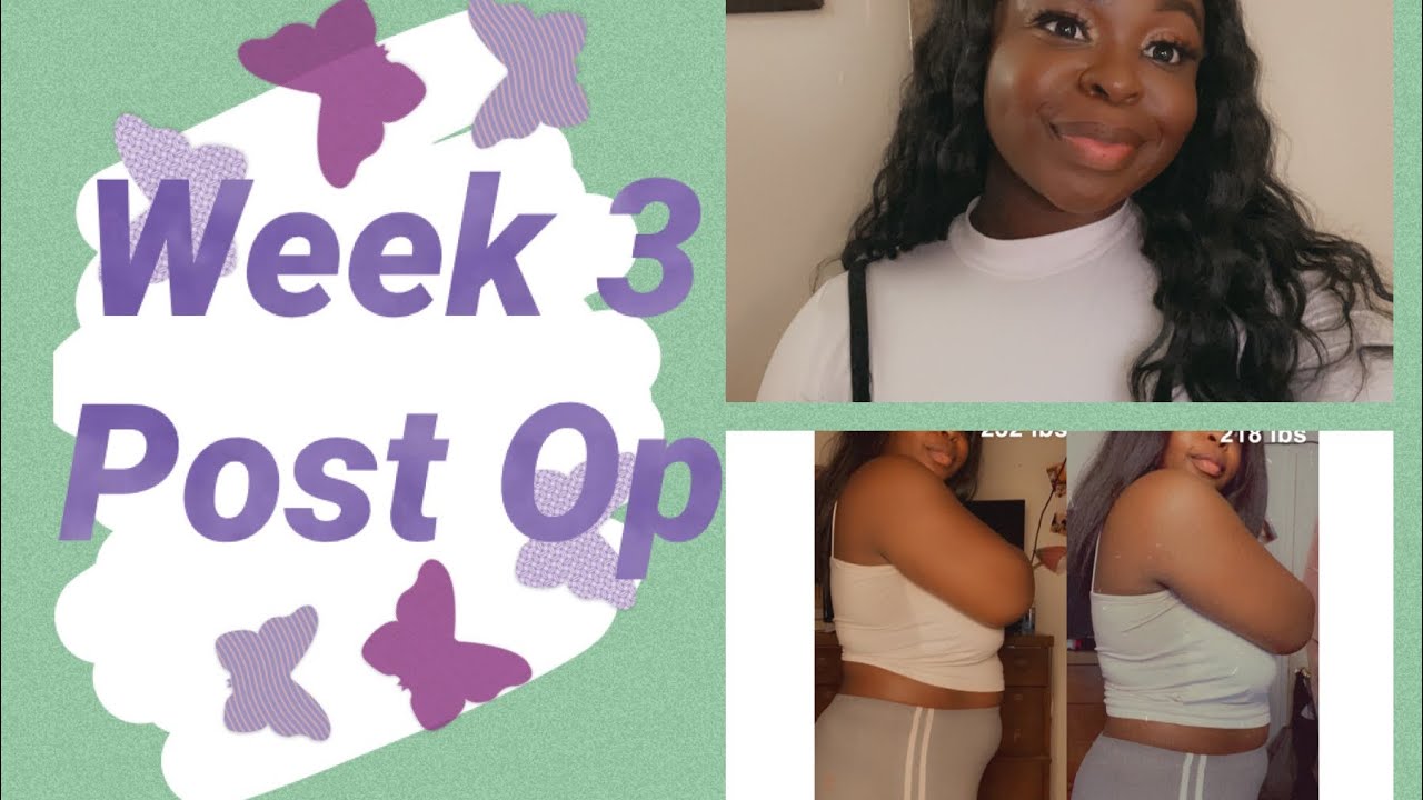 GASTRIC SLEEVE SURGERY (VSG) | Post op week 3