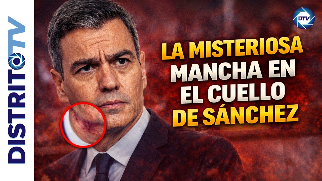🔴SE CONFIRMAN LOS PROBLEMAS DE SALUD DE S&Aacute;NCHEZ: LA MISTERIOSA MARCA EN EL CUELLO🔴