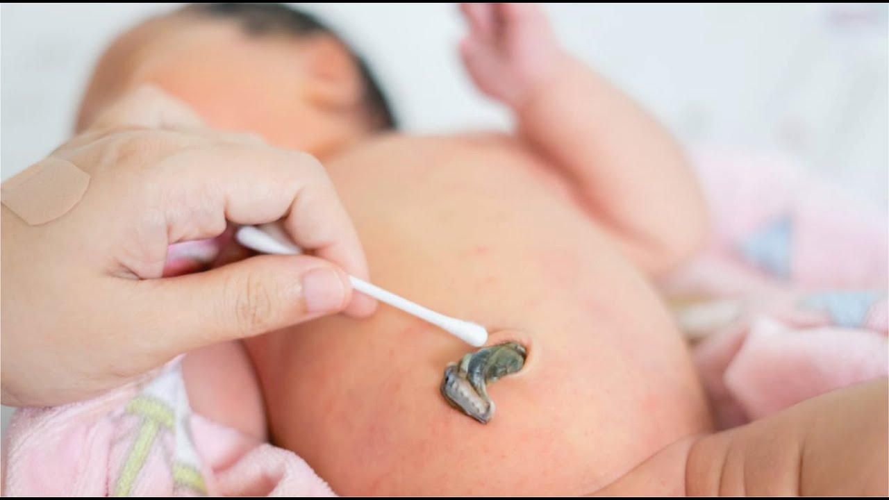 ¿Porqué esperar 3 minutos para cortar el Cordón Umbilical?