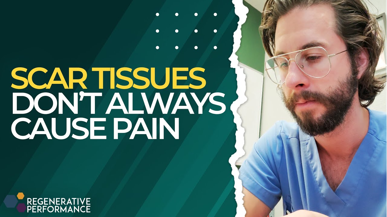 Scar Tissues Don&rsquo;t Always Cause Pain