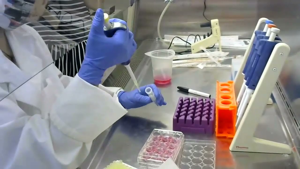 Lab 5: Change Media and OGM