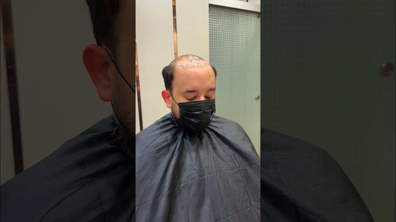 Premium Lace Hair Patch | Hair Patch for men #delhihairfixing #hairpatch