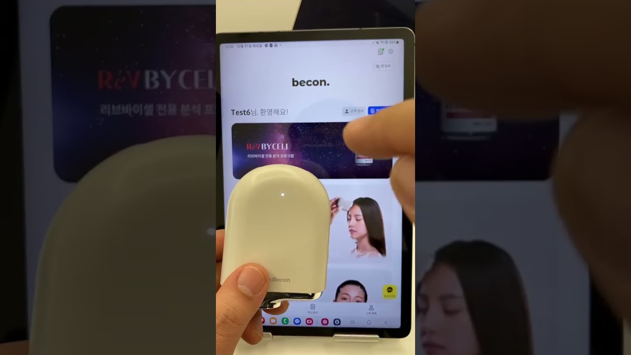 비컨 AI 스캐너&앱 연결+촬영:AI 진단기 비컨 생활백서!!