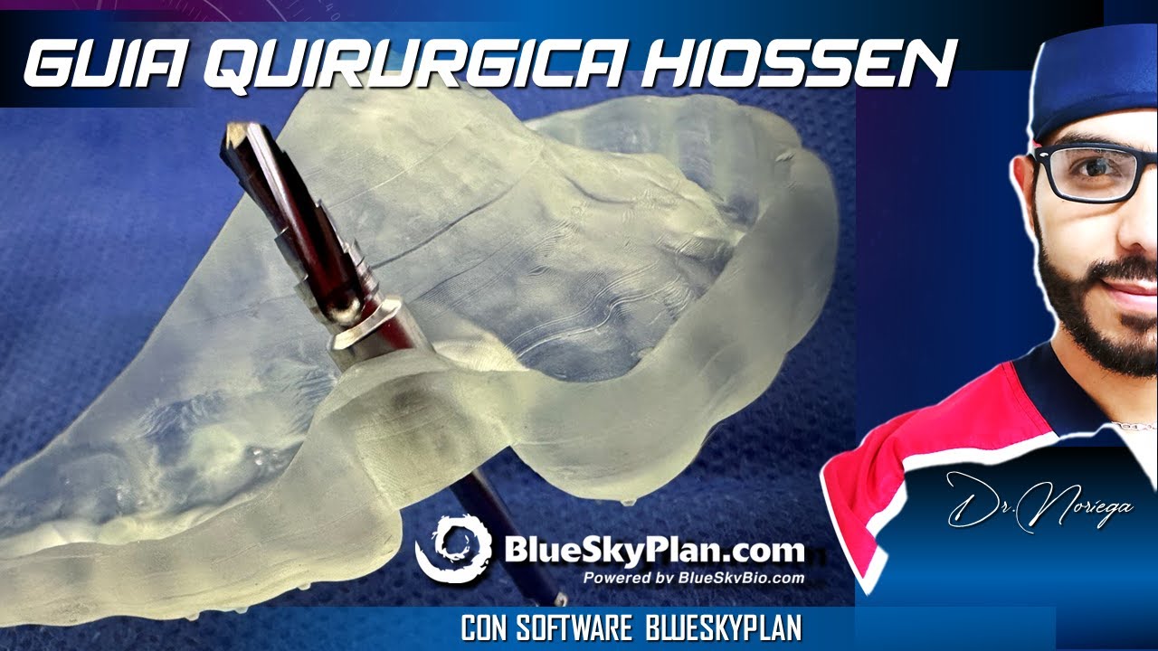 GUIA QUIRURGICA HIOSSEN CON SOFTWARE BLUESKYPLAN ¬ Dr. Noriega