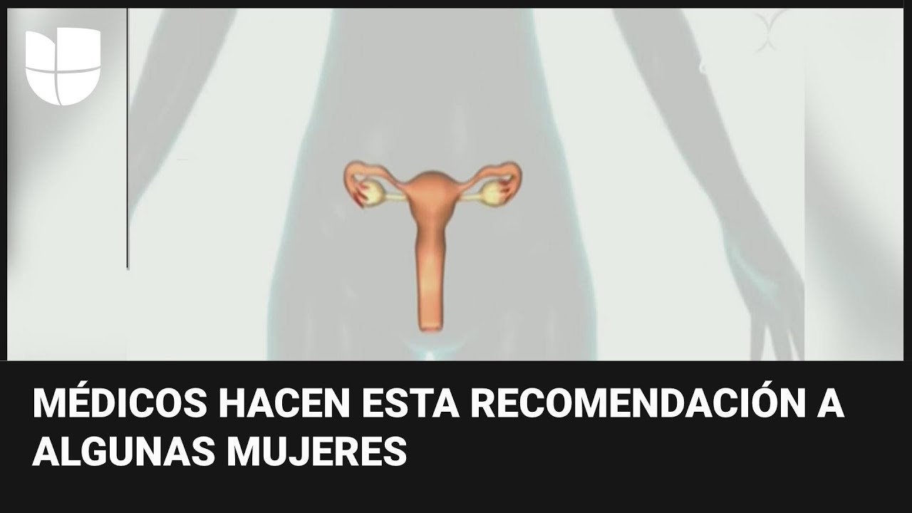 ¿Por qué se está recomendando quitar las trompas de Falopio para prevenir el cáncer de ovario?