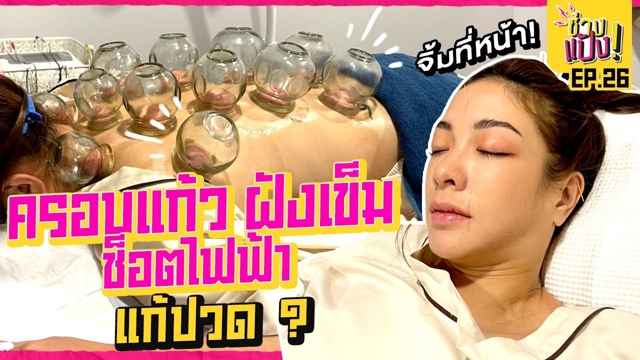 ฝังเข็ม ครอบแก้วเผาไฟ จะทนไหวไหม? หายปวดจริงรึเปล่า? | ช่างแป้ง EP.26