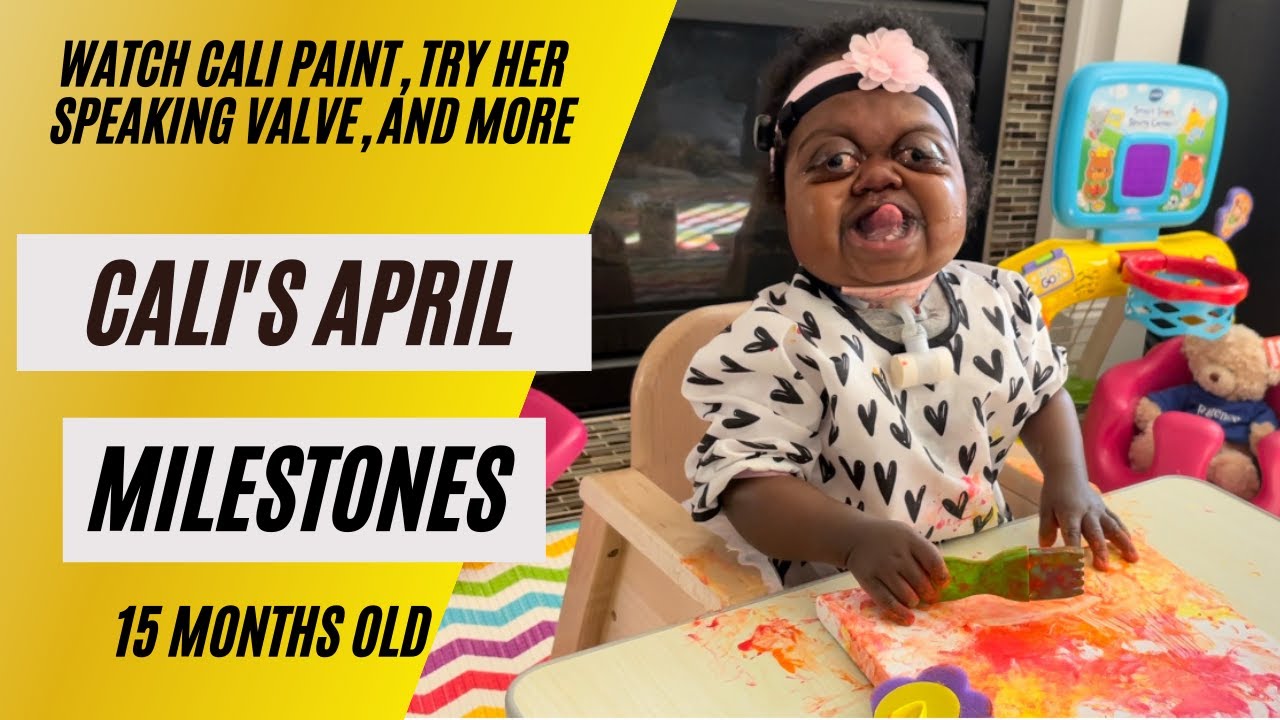 Cali's April Development Milestones | 15 Month Infant| Special Needs| Pfeiffer Syndrome