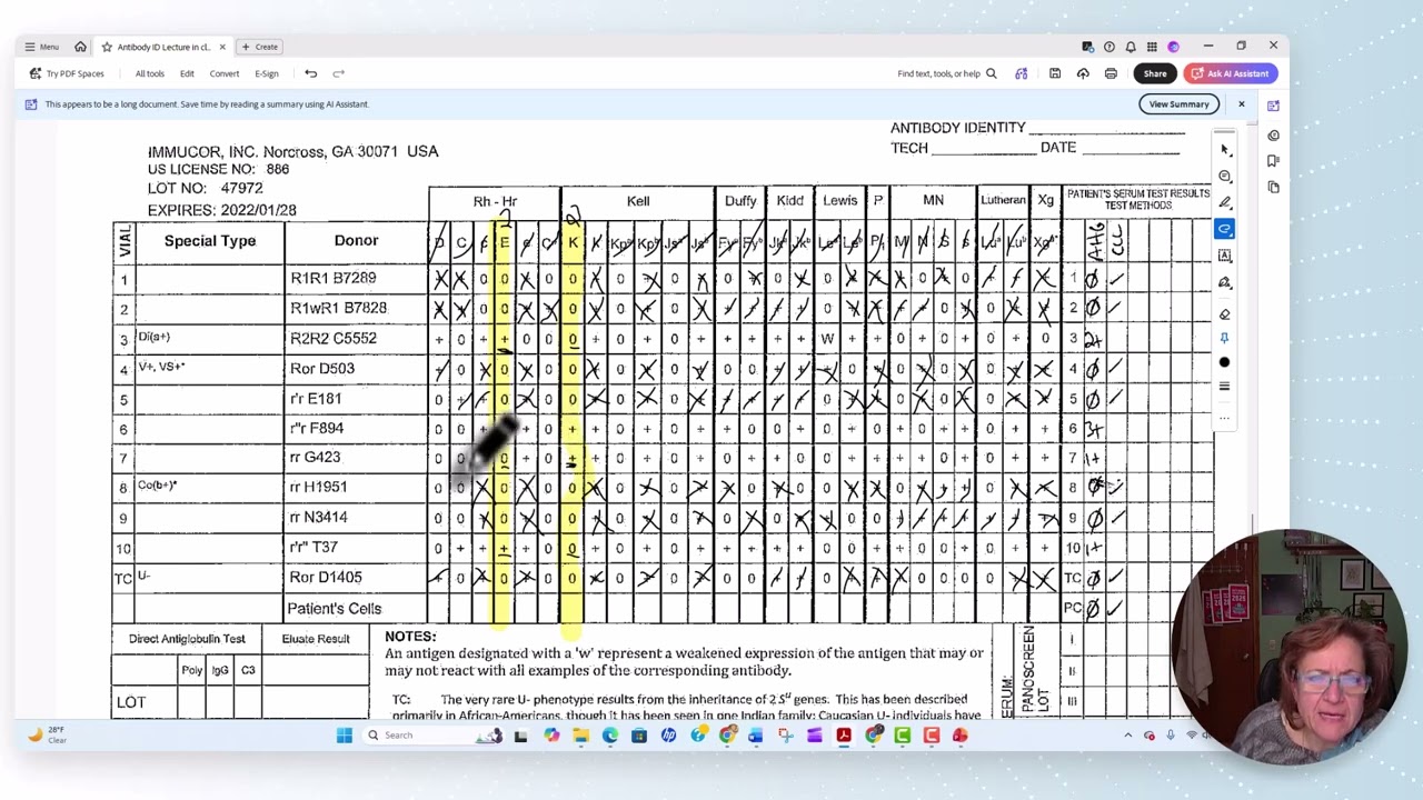 BB Lecture 9.5 Antibody ID part 2