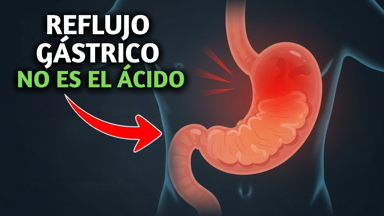 El Error Diario que Provoca el Reflujo G&aacute;strico (Y C&oacute;mo Corregirlo)