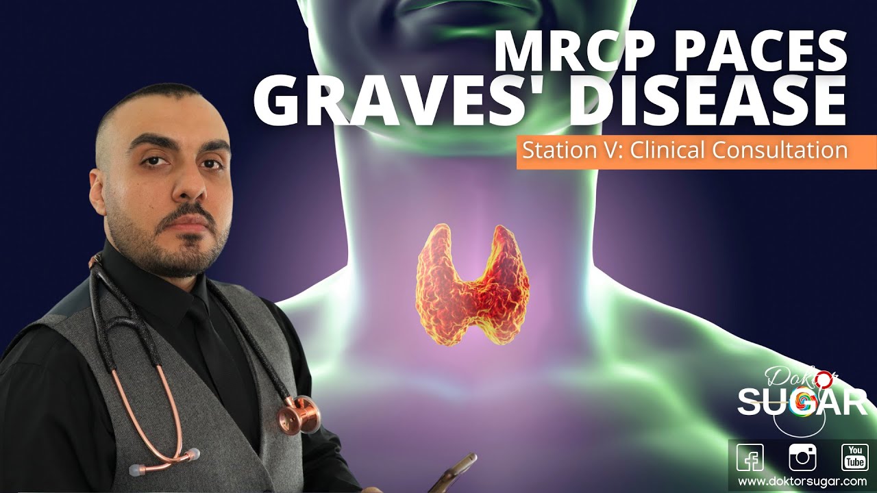 MRCP PACES - Station 5 - Graves' Disease