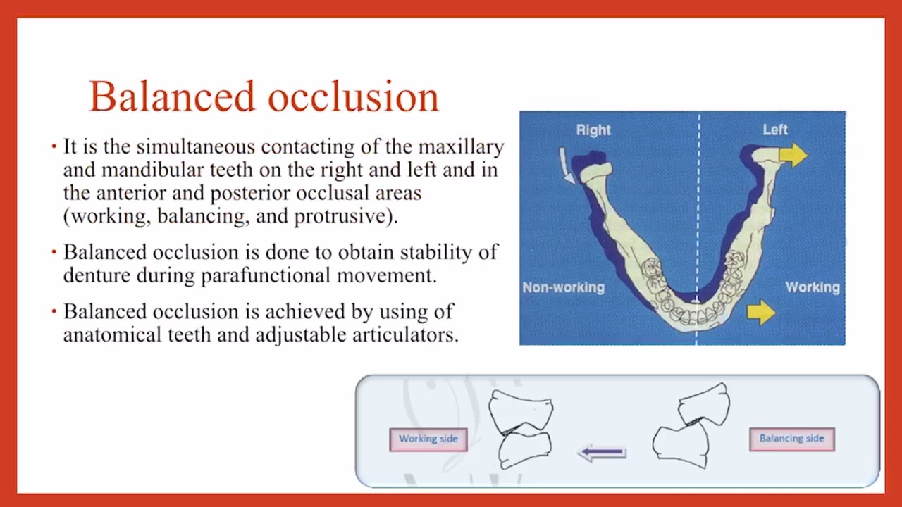 2-13 Prosthodontics, Occlusion.
