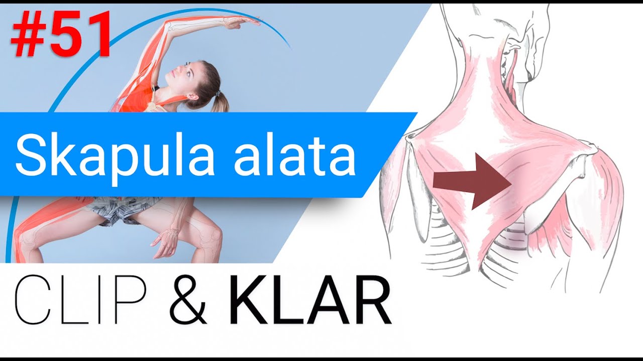 Skapula alata erkl&auml;rt - Engelsfl&uuml;gel ohne 