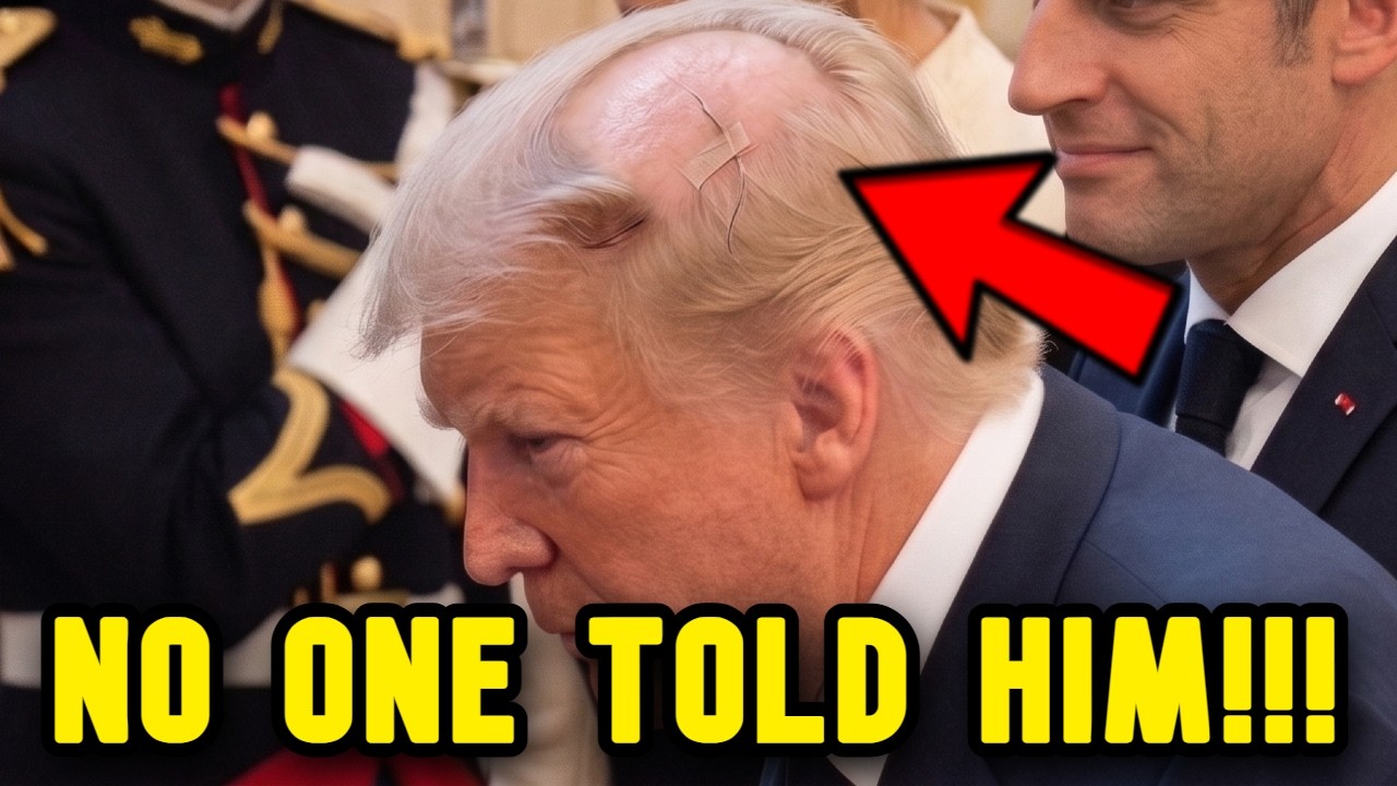 TRUMPS TOUPEE WAS FALLING OFF AT G7...