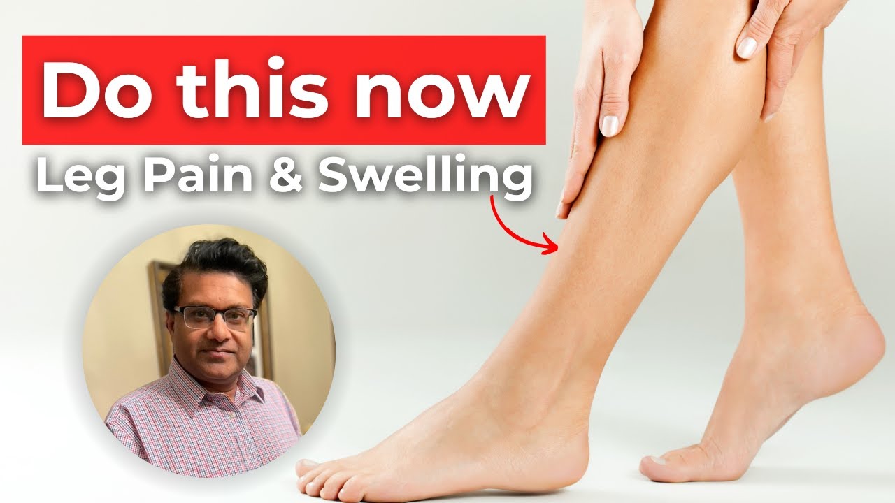 How to Check for a Blood Clot in Your Leg (DVT): Signs, Symptoms, and Treatment