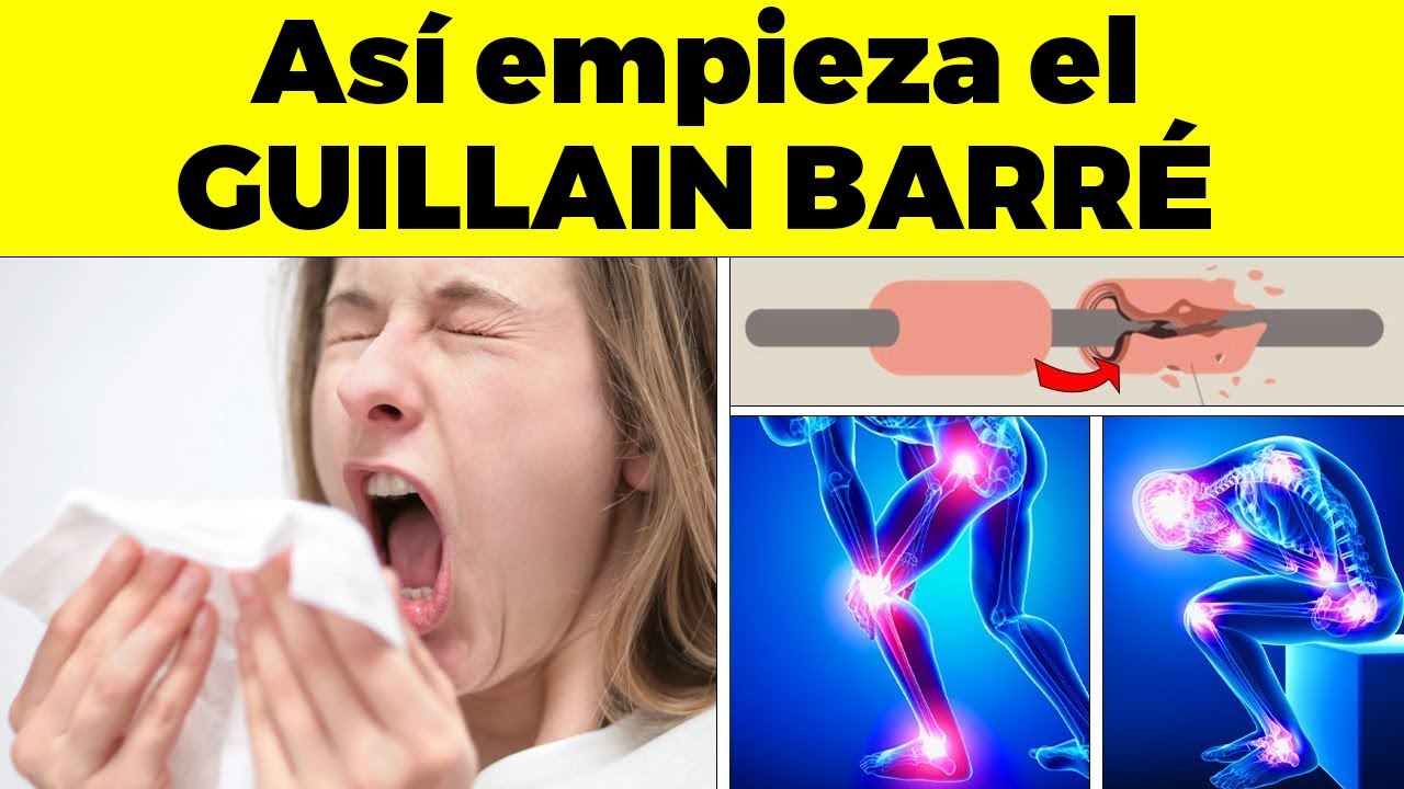 ¡ASI EMPIEZA EL GUILLAIN BARRÉ en adultos - y nadie te lo dice