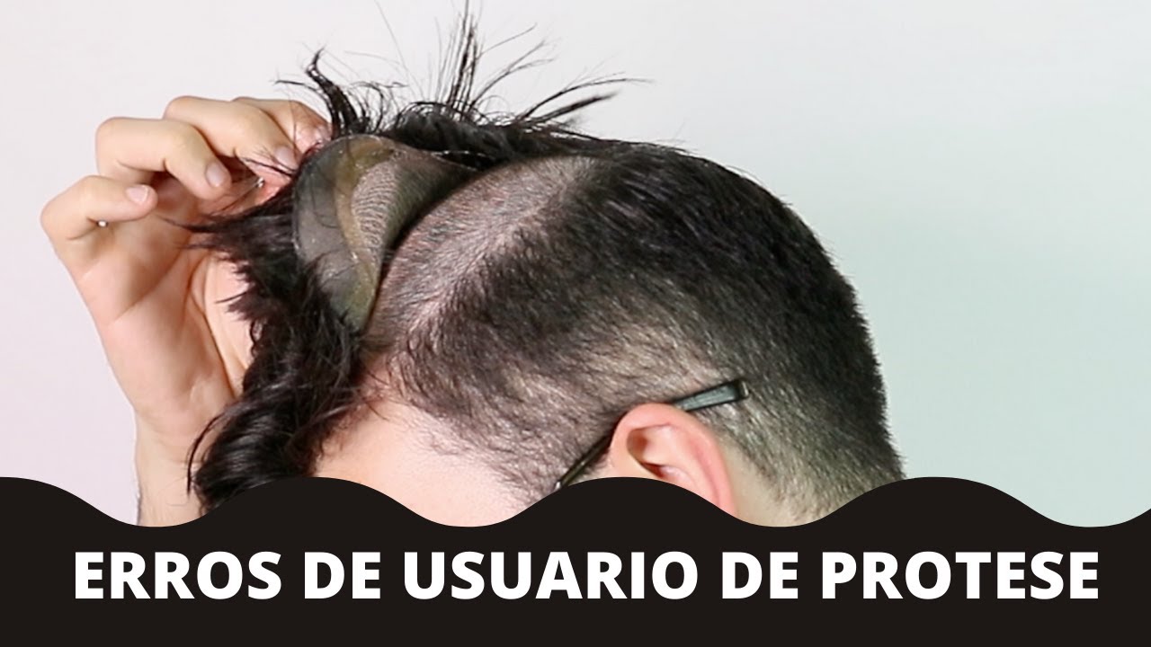 OS MAIORES ERROS DE QUEM VAI USAR, USA PROTESE CAPILAR | #PROTESECAPILARMASCULINA| @JADSON.ANDRESEN
