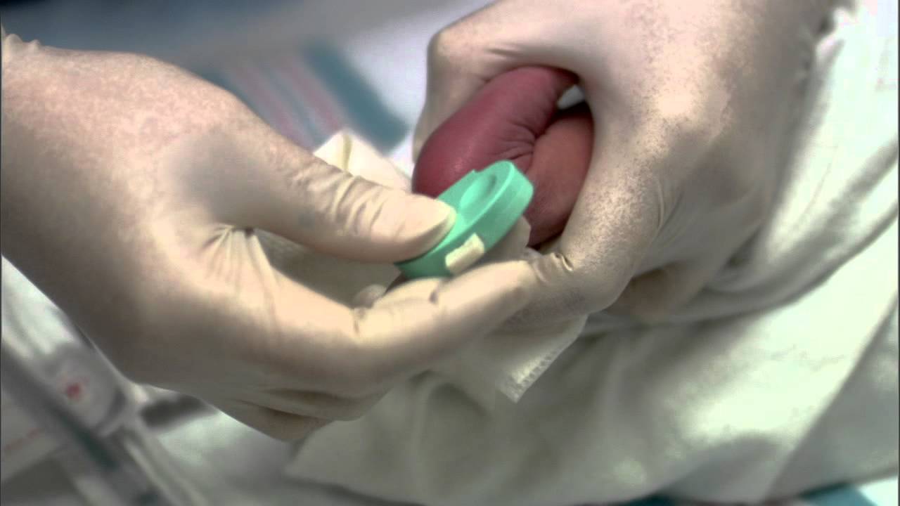 Pruebas para los recién nacidos