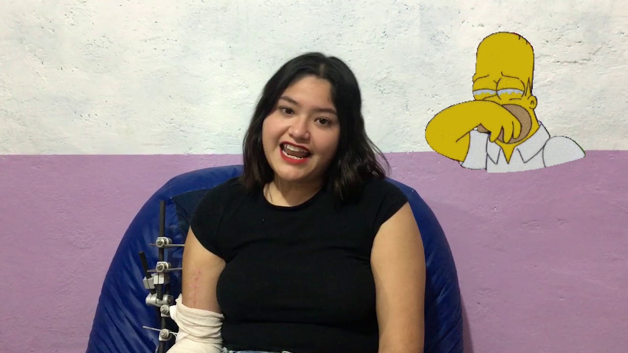 Mi experiencia tras perder mi brazo.
