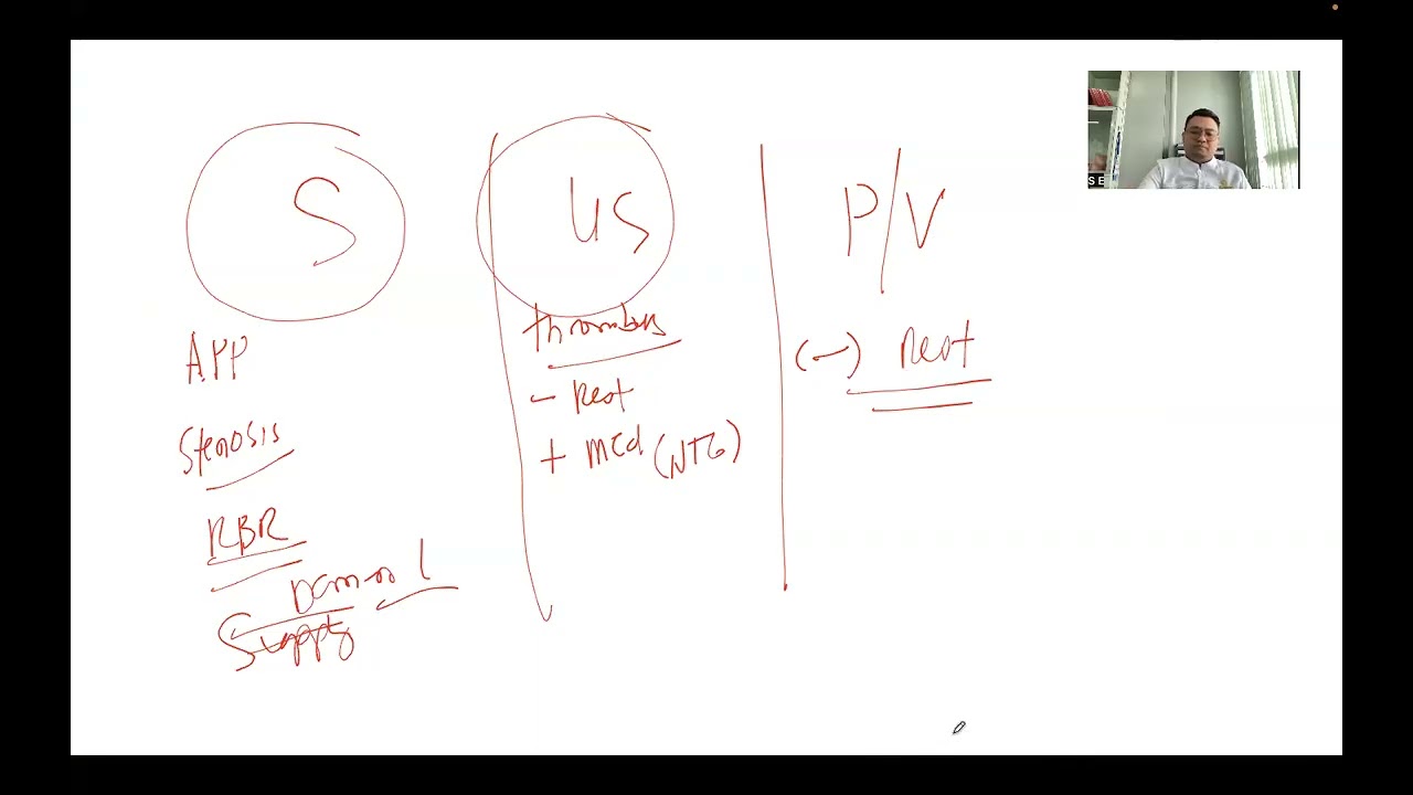 CARDIO Series: Angina pectoris