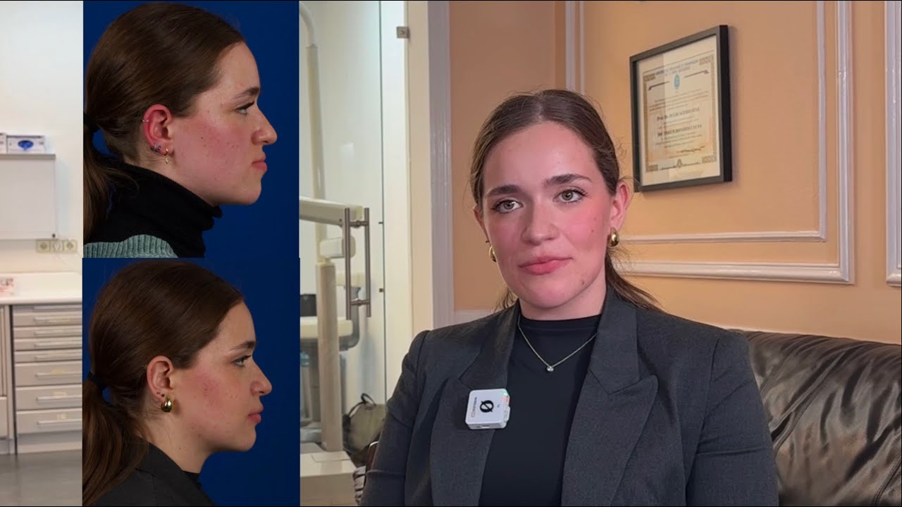 Entrevista postoperatoria 5: clase III con asimetría