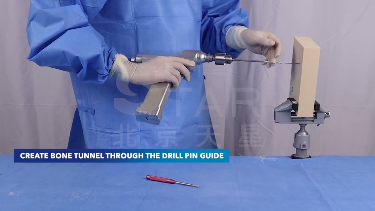 STAR Lateral Ankle Ligament Reconstruction (ATFL & CFL) - User Guide
