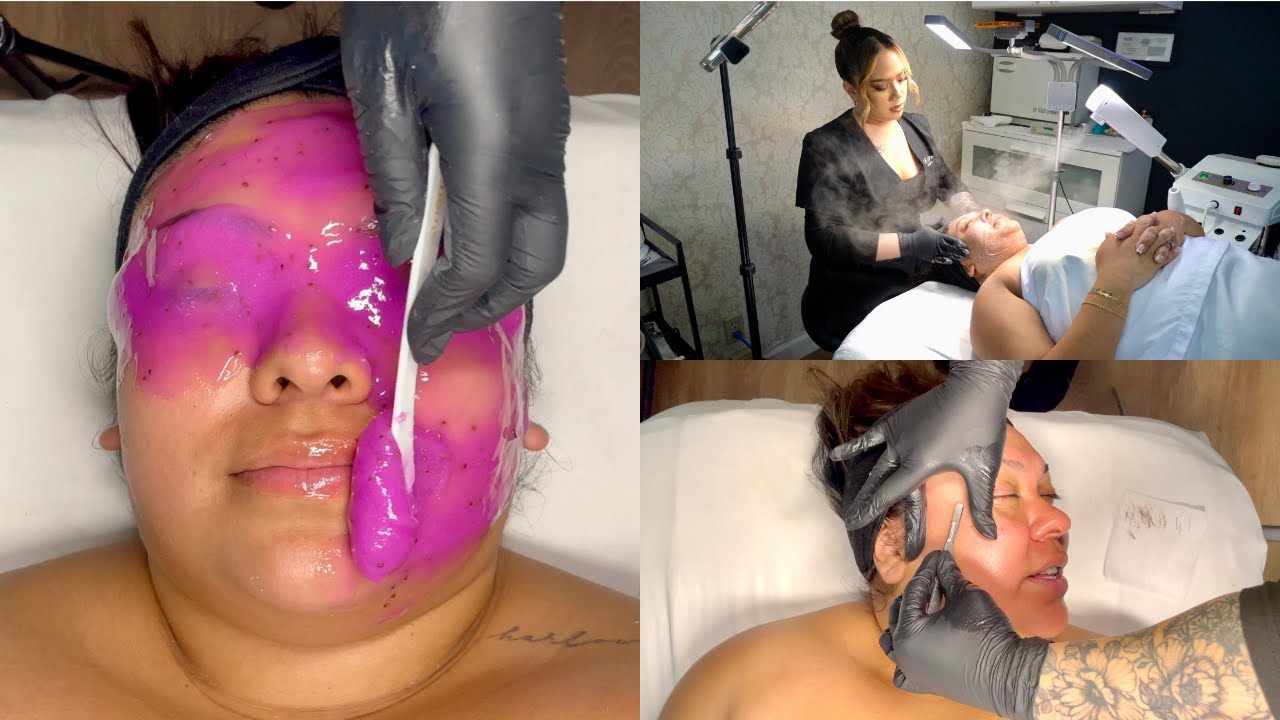 Дермапланинг для лица для жирной комбинированной кожи | Skin Talk, выпуск 1 | BEAUTYBYXIOMARA x K...