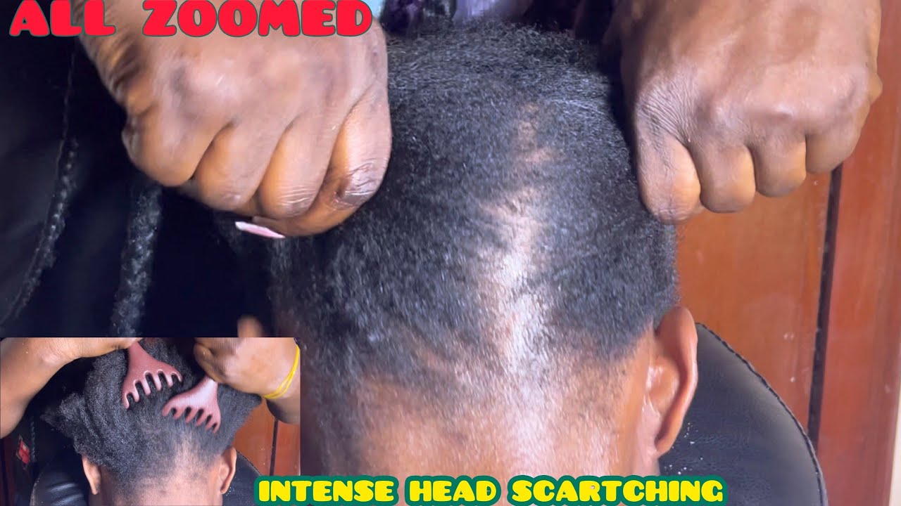 ASMR✨ALL ZOOMED INTENSE HEAD SCRATCH, NIT PICK, INTENSE NAPE MASSAGE AND HAIR PULLING WITH GUM.
