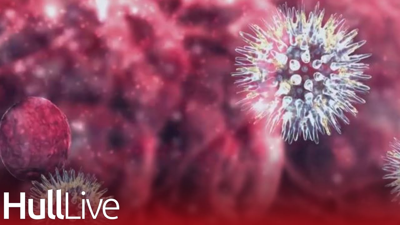 New symptoms of Covid strain Pirola to look out for