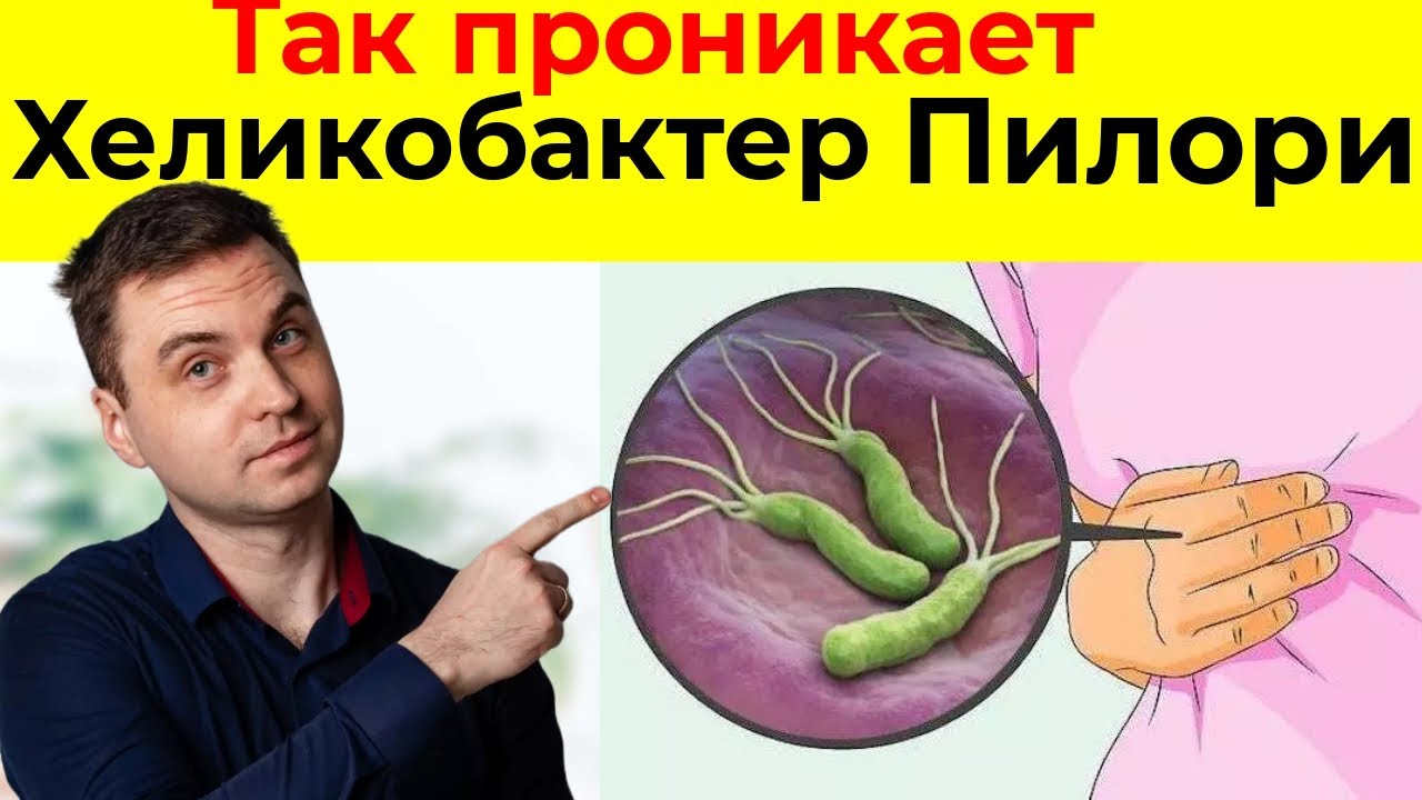 НЕ ИГНОРИРУЙТЕ эти 5 Признаков того,что у вас есть Хеликобактер Пилори. Чтобы избежать ЯЗВЫ ЖЕЛУДКА