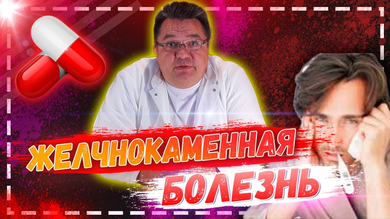 Желчнокаменная болезнь.Особенности консервативного лечения. Доктор Косов.