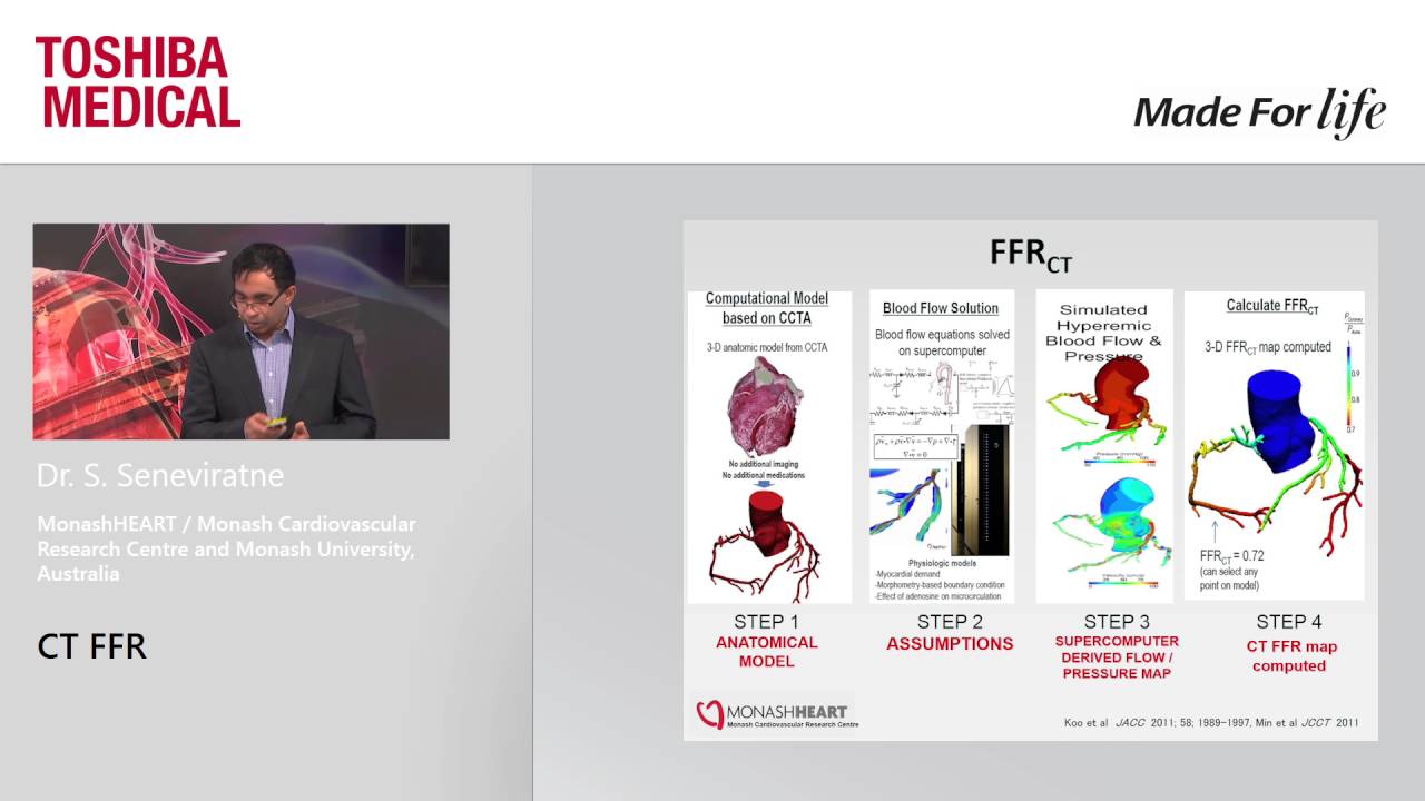Dr. S. Seneviratne at ESC 2016 - 
