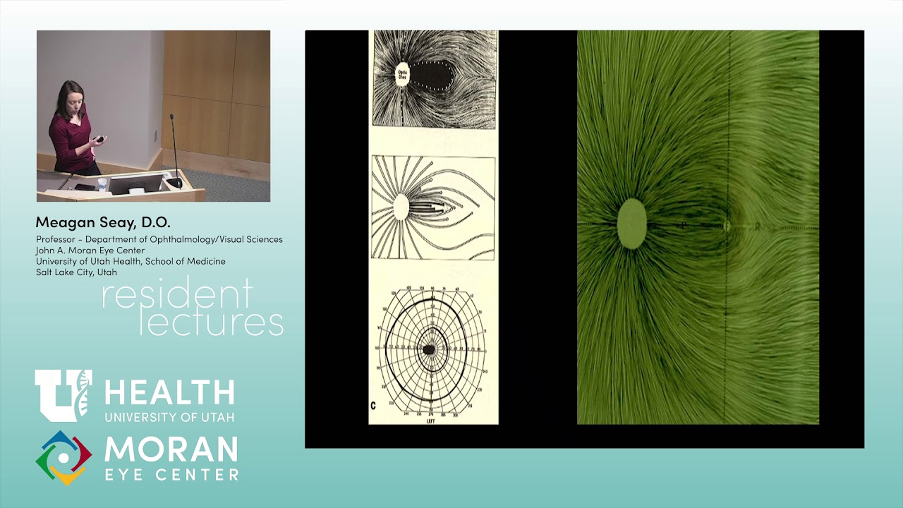 Visual Field Testing and Cases