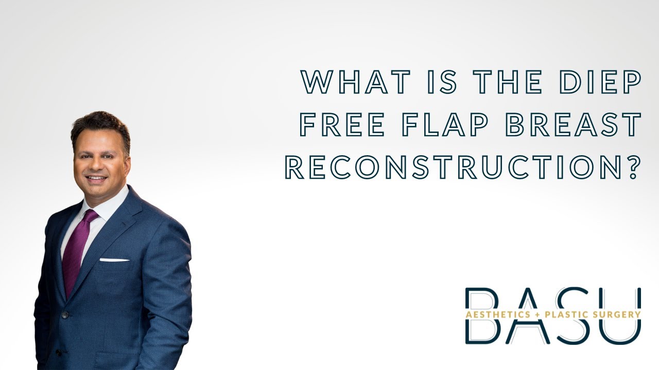 What is the DIEP free flap breast reconstruction procedure?