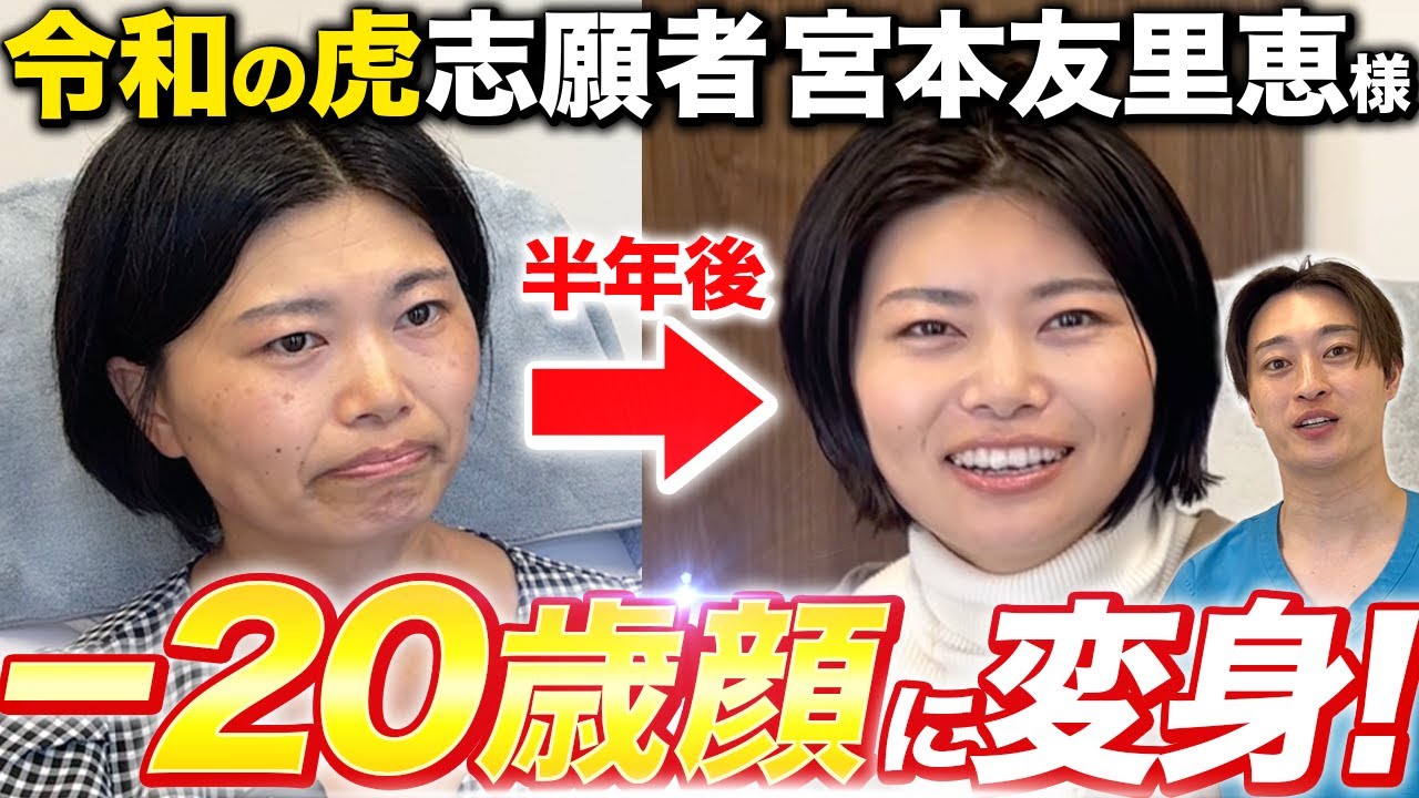 【令和の虎】半年かけて志願者の宮本友里恵さんの顔が大変身を遂げました