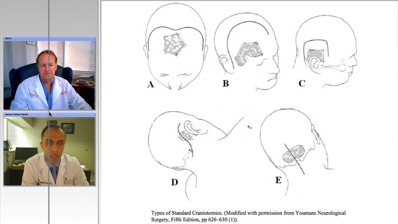 Patient Positioning for Intracranial Surgery: A Guide for Residents and Fellows (Preview)