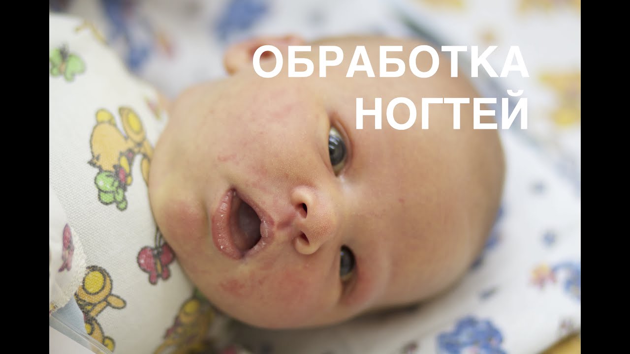 Как обрабатывать ноготочки новорожденных II ОВП