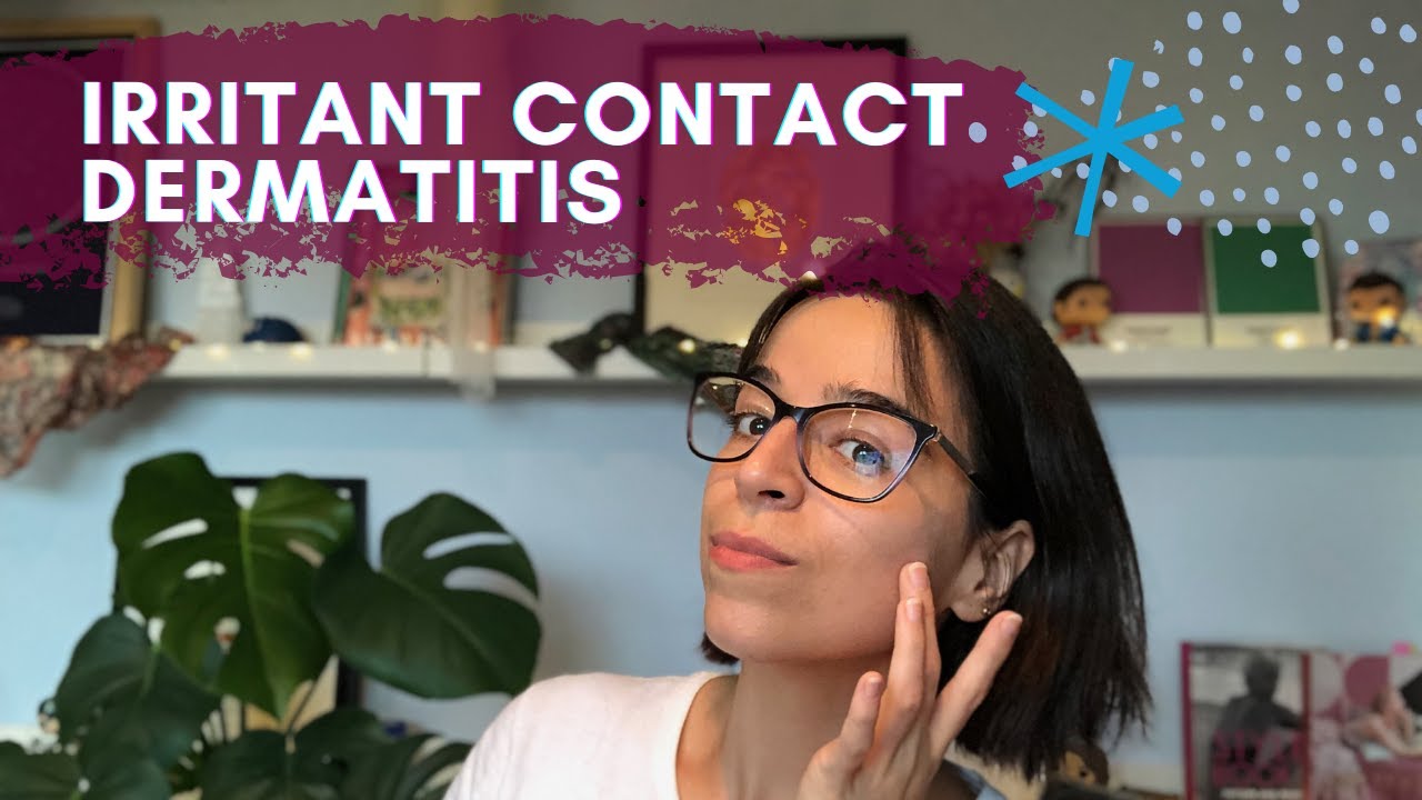 irritant contact dermatitis | how I deal with it, treat and heal my skin
