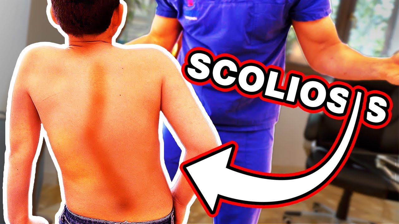 Boy with Spine Issues is HELPED with Chiropractic