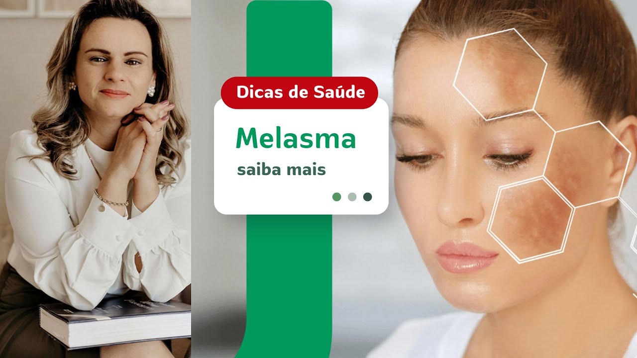 Dicas de Saúde 15/01/2026 - Melasma