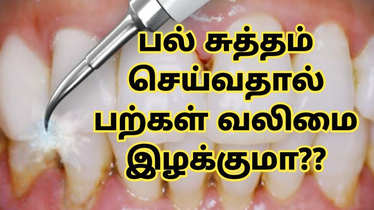 Does scaling(Teeth cleaning) of teeth make teeth weak? | Facts and myths | Dr.Sandhya | Tamil