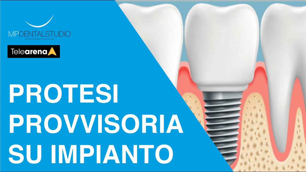 Protesi provvisoria su impianti: tutto quello che devi sapere - Prof. Makarati a Dica33, Telearena