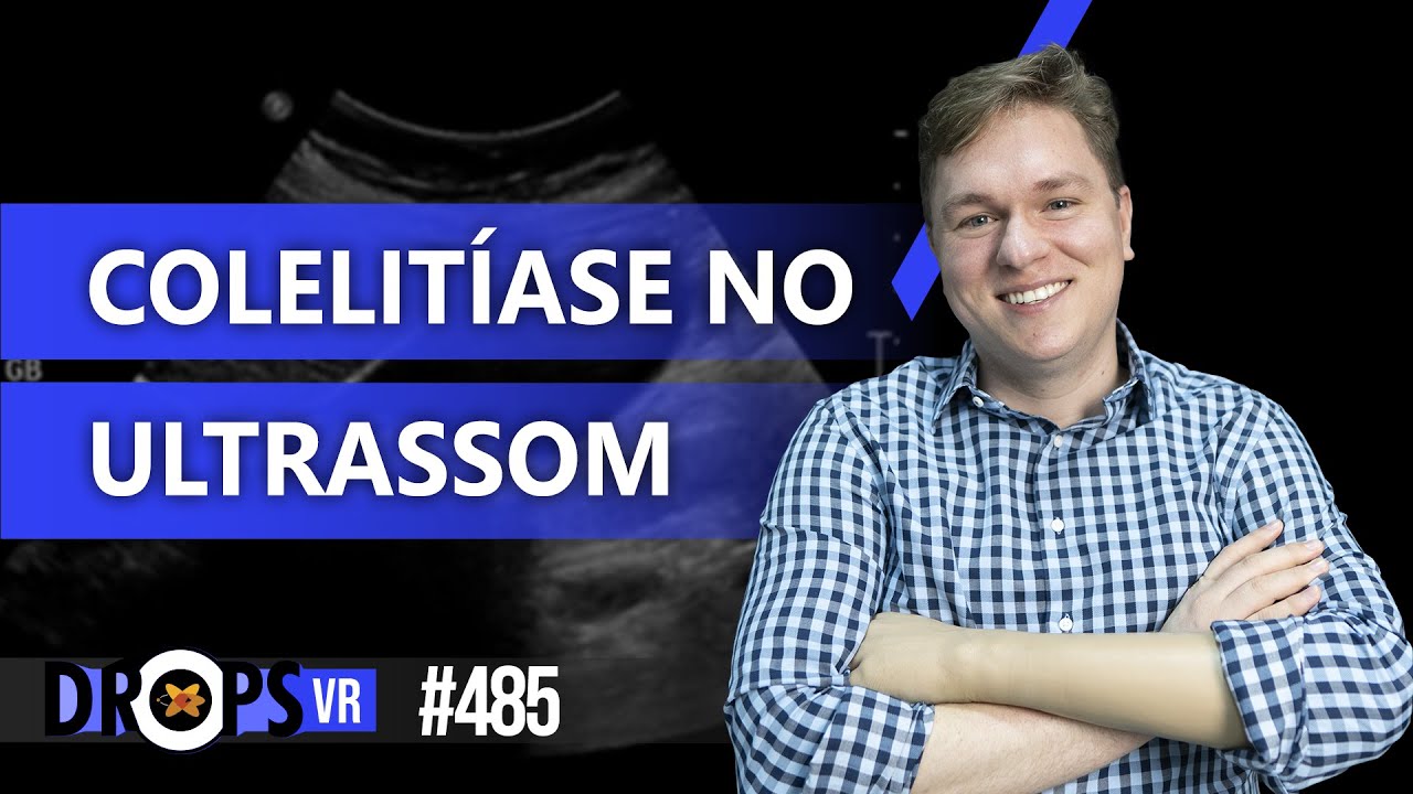 COMO RECONHECER COLECISTOLITÍASE NO ULTRASSOM