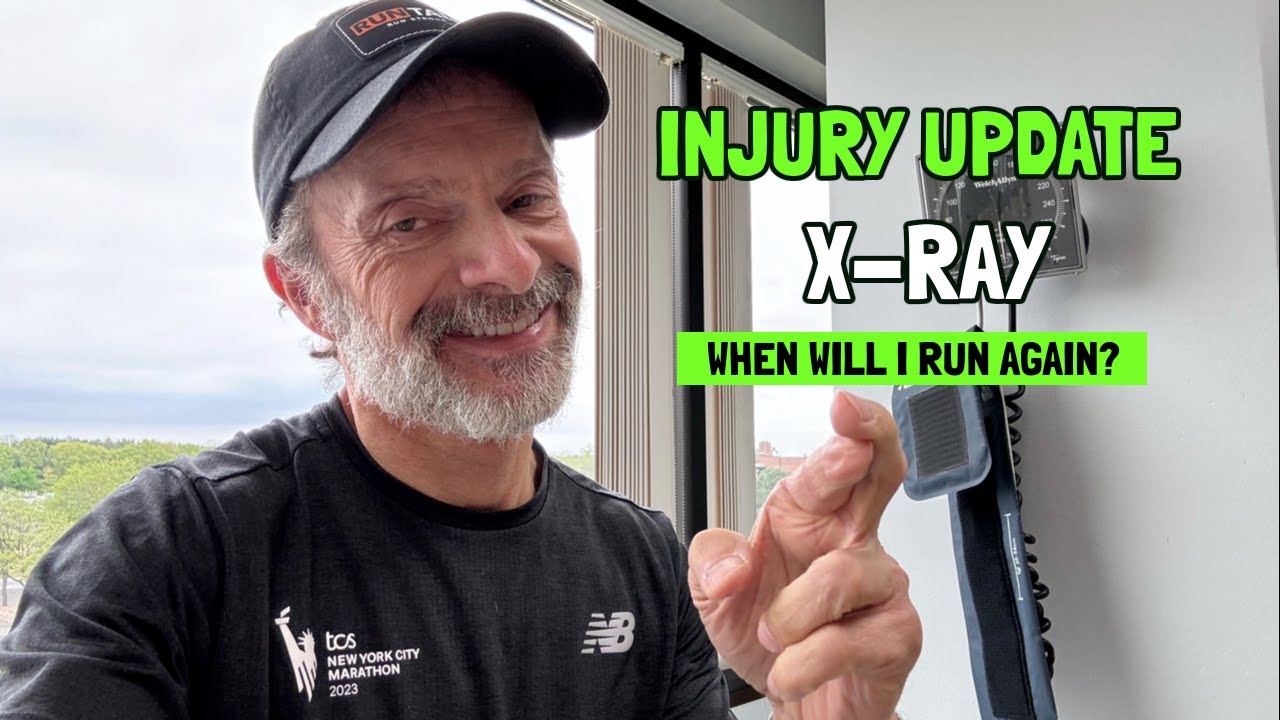 Injury Update | X-Ray | When Will I Run Again?