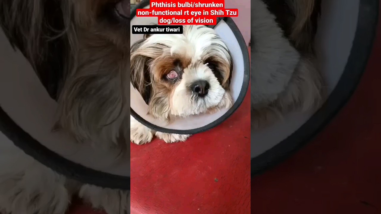 #loss of vision #phthisis bulbi