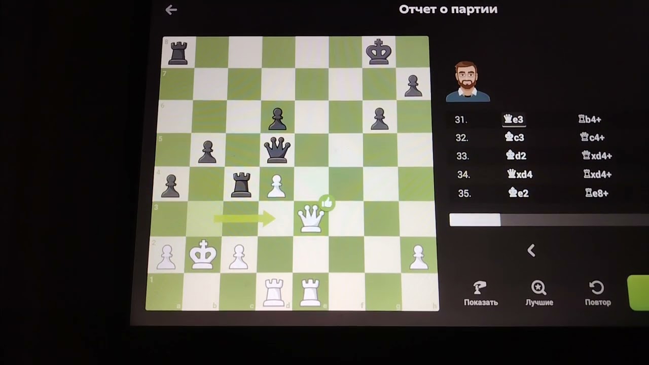 АРМИЯ ПЕШЕК ДВИЖЕТСЯ В ФЕРЗИ