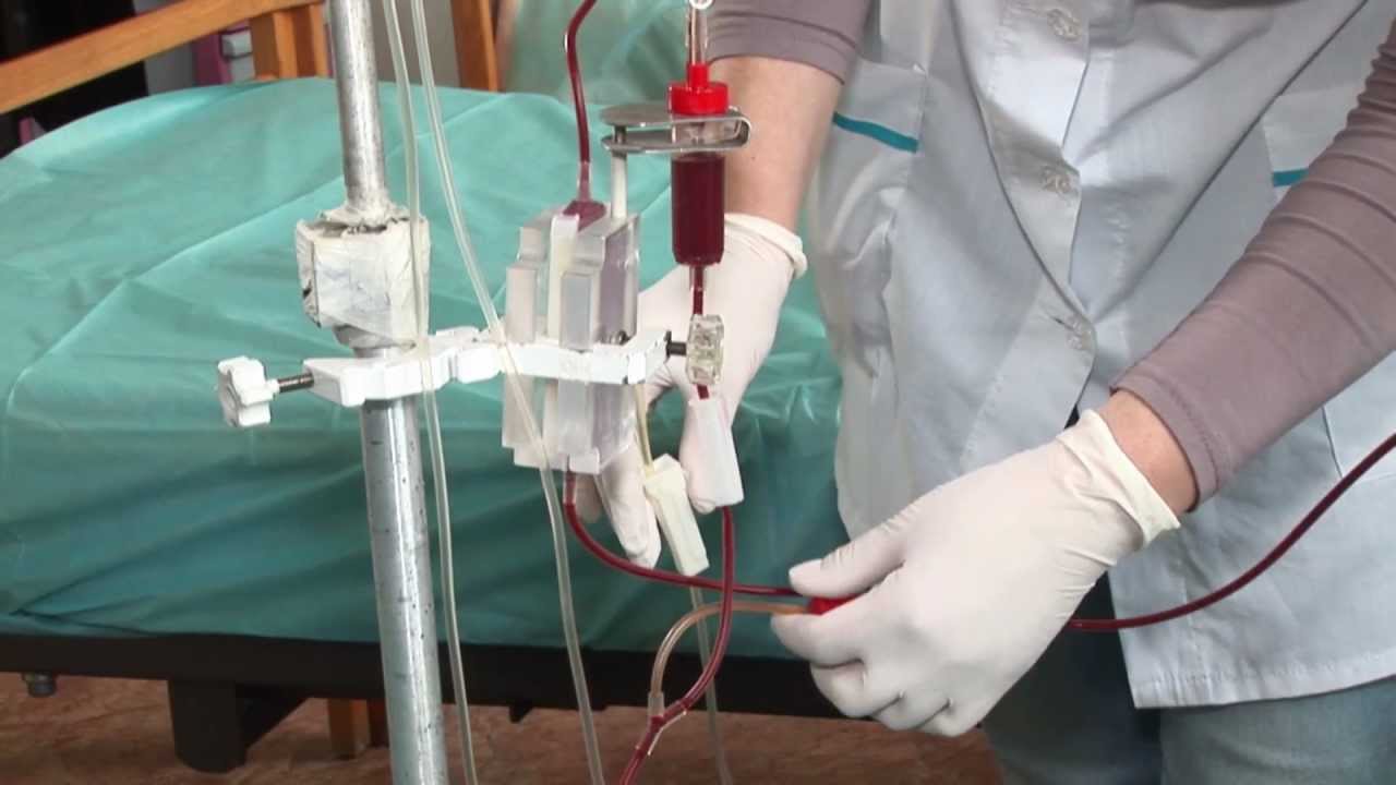 Society for the Advancement of Blood Management (Donate Today!) | SABM