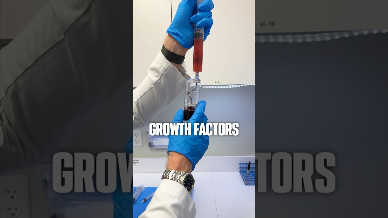 Process of PRP Part 4 #prp #healthandwellness