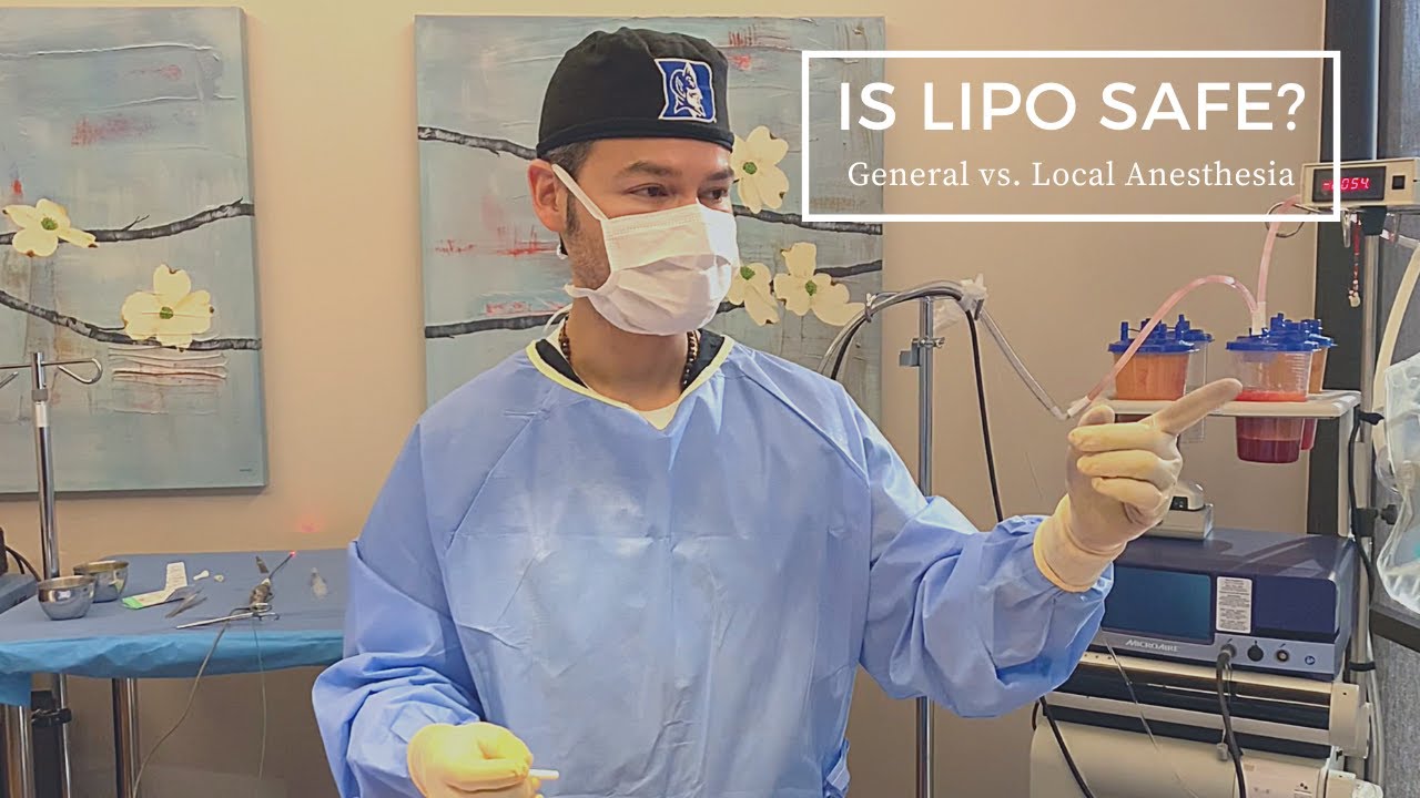 Is Liposuction Safe? Local Anesthesia for SmartLipo Patients